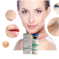 Remove Wrinkles Counter Dermal Fillers For Face Hands