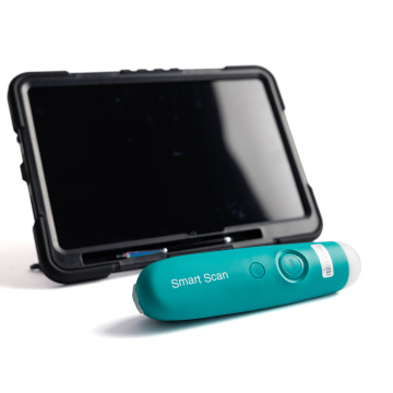 SmartScan D portable livestock ultrasound machine