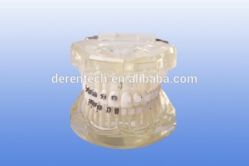 Standard dental model , transpartnet orthodontic model
