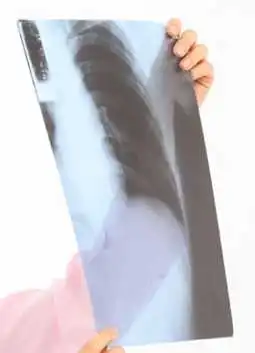 medical equipments alibaba china film