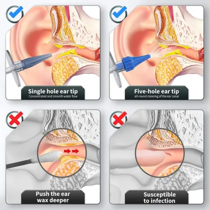 2024 Cheap Ear Wax Cleaner Tool with Accessories - Soft Silicone Ear Wax Remover