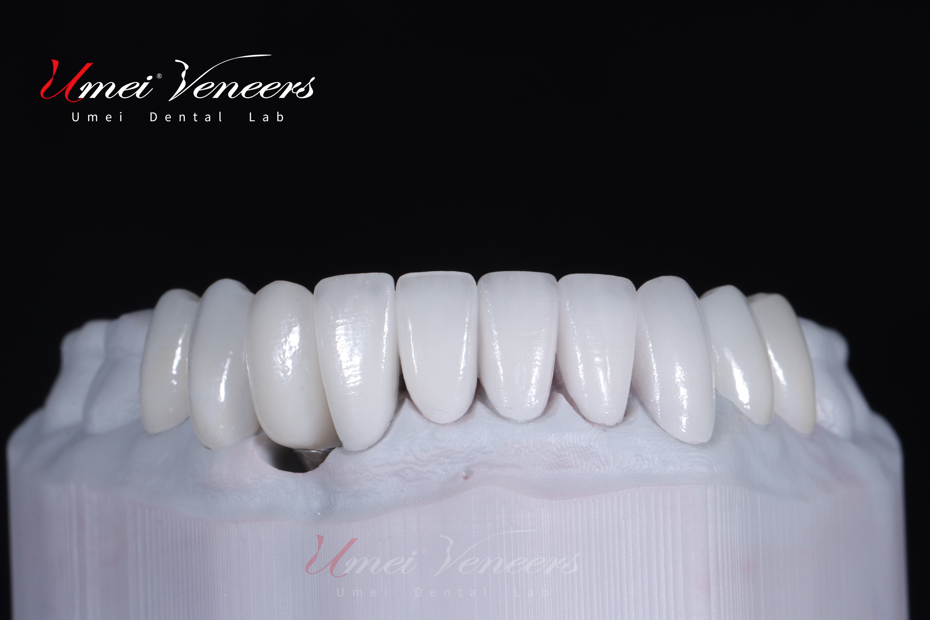 Καπλαμάδες ζιρκονίας Zirconia Layered Veneers