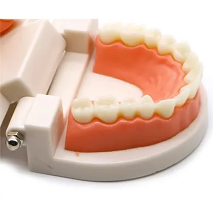 Orthodontic Dental Pathological Implant Teeth Model Study