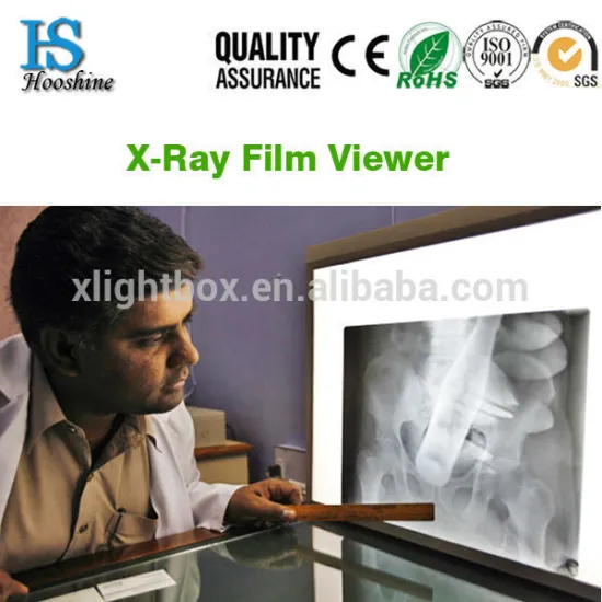 Four bank medical film viewbox/LED backlight