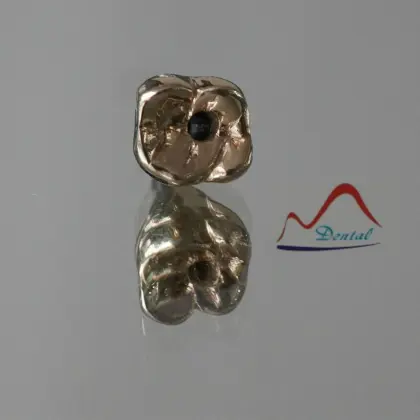 Dental implant full metal gold crown