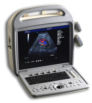 Cheap Price Color Doppler Ultrasound Machine
