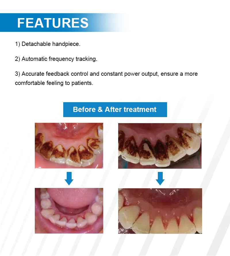 Electric Dental Scaler Ultrasonic (2)