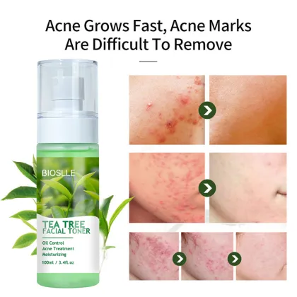BIOSLLE OEM Natural Tea Tree Anti-Acne Hydrating Toner