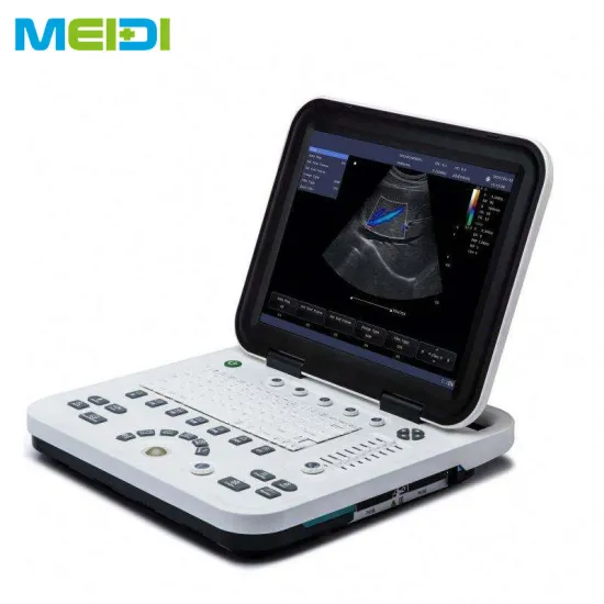 Full Digital Color Doppler Scanner for Laptop