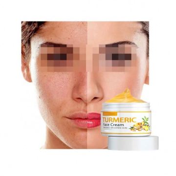 Turmeric and Snail Cream: High-Effective Facial Kit for Fast Action on Your Skin Care Needs - OEM & Private Label Options
