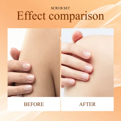 Himalaya Body Scrub Deep Cleansing