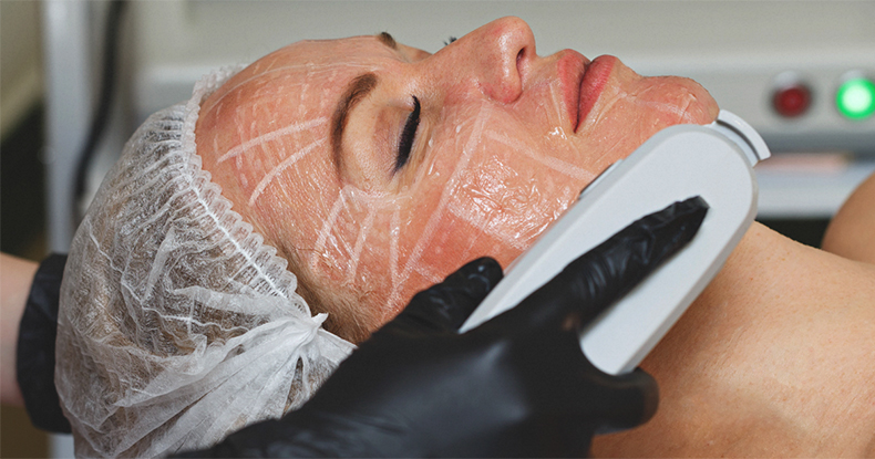 NEW NON-INVASIVE ULTHERAPY SMAS FACE LIFTING SKIN TIGHTENING HIFU MACHINE