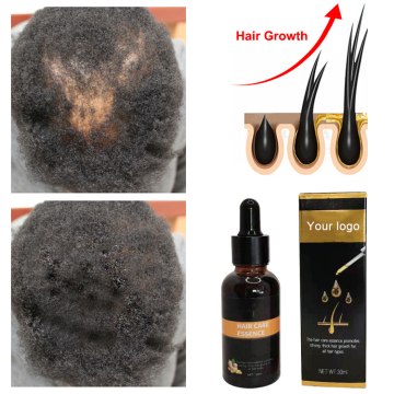 Private-Label-Haarwachstum Ölserum: Neuankömmlinge glättungsreparieren Anti-Verlust-Nachwachsen der Kopfhautelixier