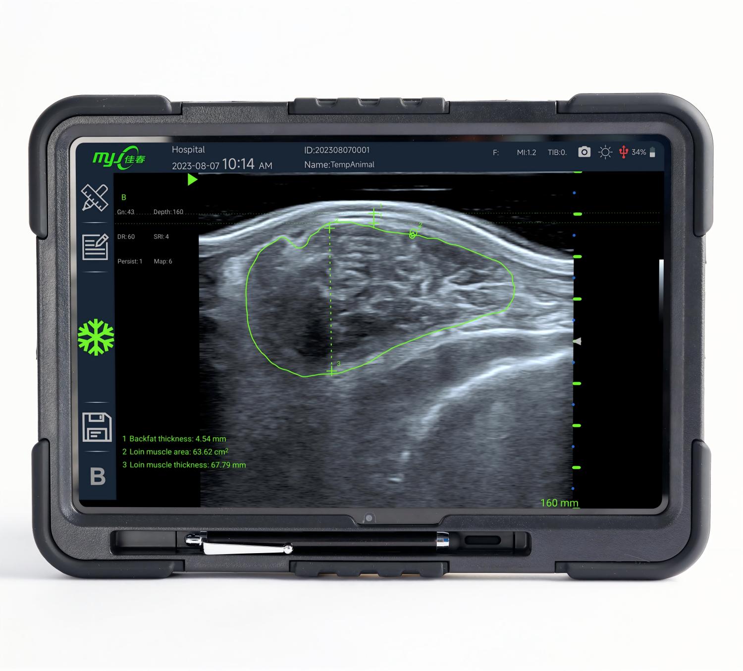 swine ultrasound pregnancy