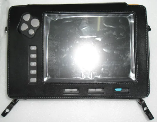 Palm Ultrasound Scanner for Cattle