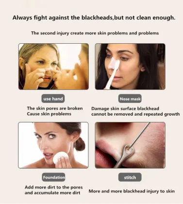 New Face Tanning Machine & Japanese Skin Care: Beauty & Personal Care Products Including Nose Blackhead Remover