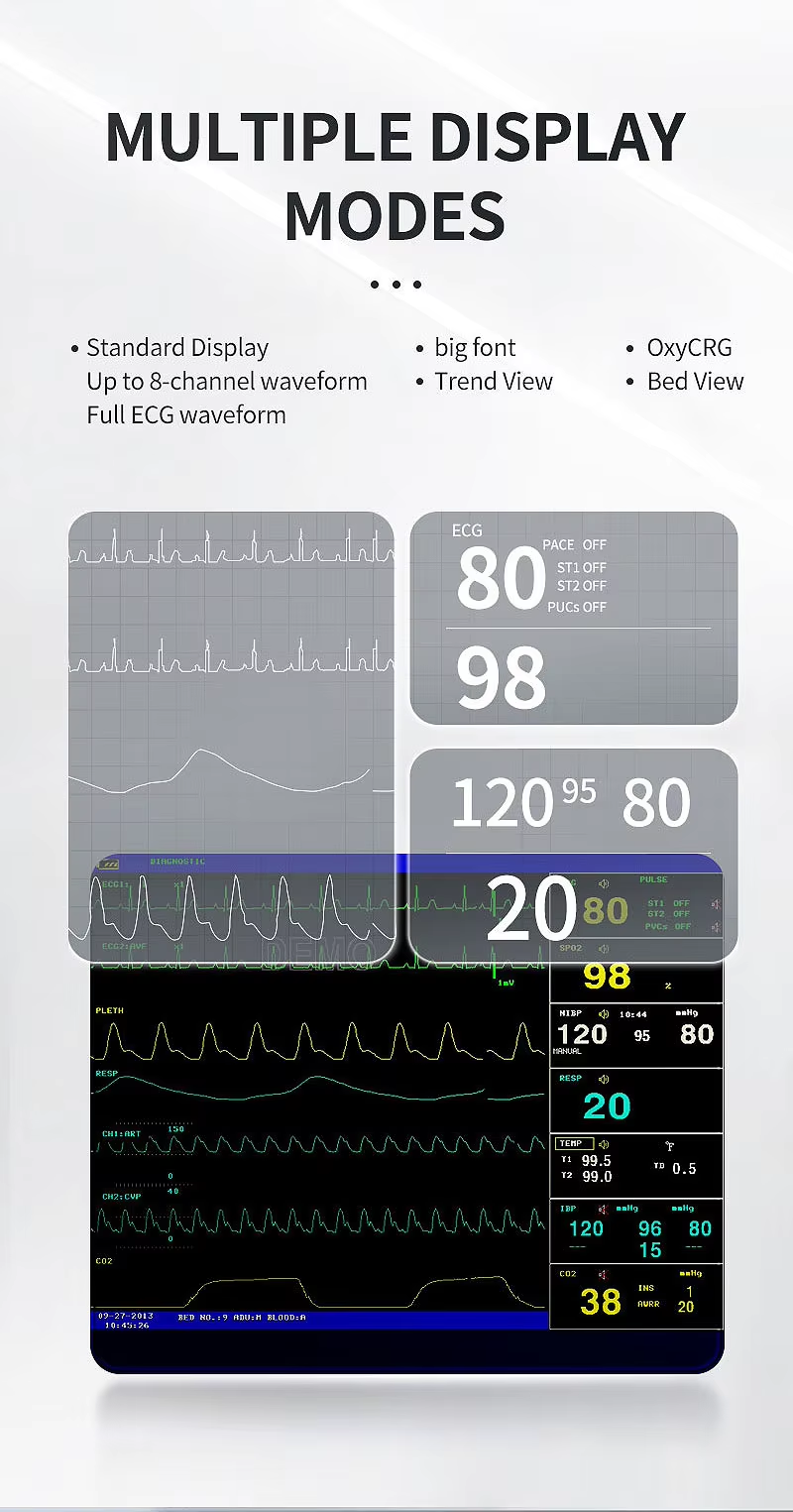 ECG Machine