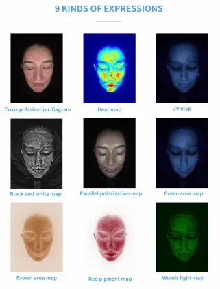 Portable Skin Analyzer: Visia Skin Analysis Machine - Magic Mirror Skin Scanner