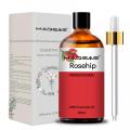 Prevención del cabello para la caída Crecimiento del cabello Rosehip Rosiohip al por mayor Fortalecimiento del aceite de cabello