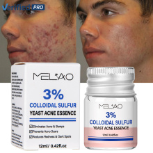 Colloidal Sulfur Acne Pimples Remover Yeast Essential