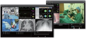 Surgical Video Teaching For Hospital