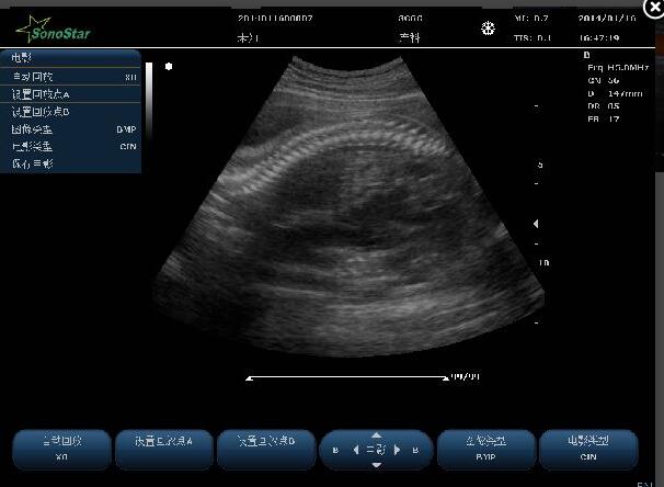 C10 Color Doppler Ultrasound System For Hostipal