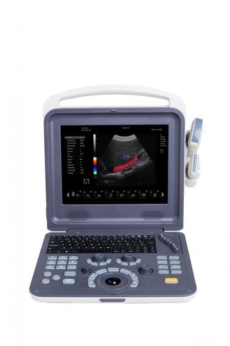 Bärbar 4D Cardiac Color Doppler Ultraljudsskanner