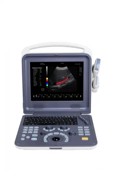 Portable 4D Cardiac Color Doppler Ultrasound Scanner
