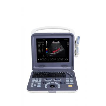 Portable 4D Cardiac Color Doppler Ultrasound Scanner