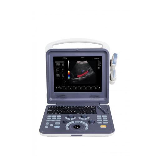 4D Portable Handheld Color Doppler Ultrasound Scanner