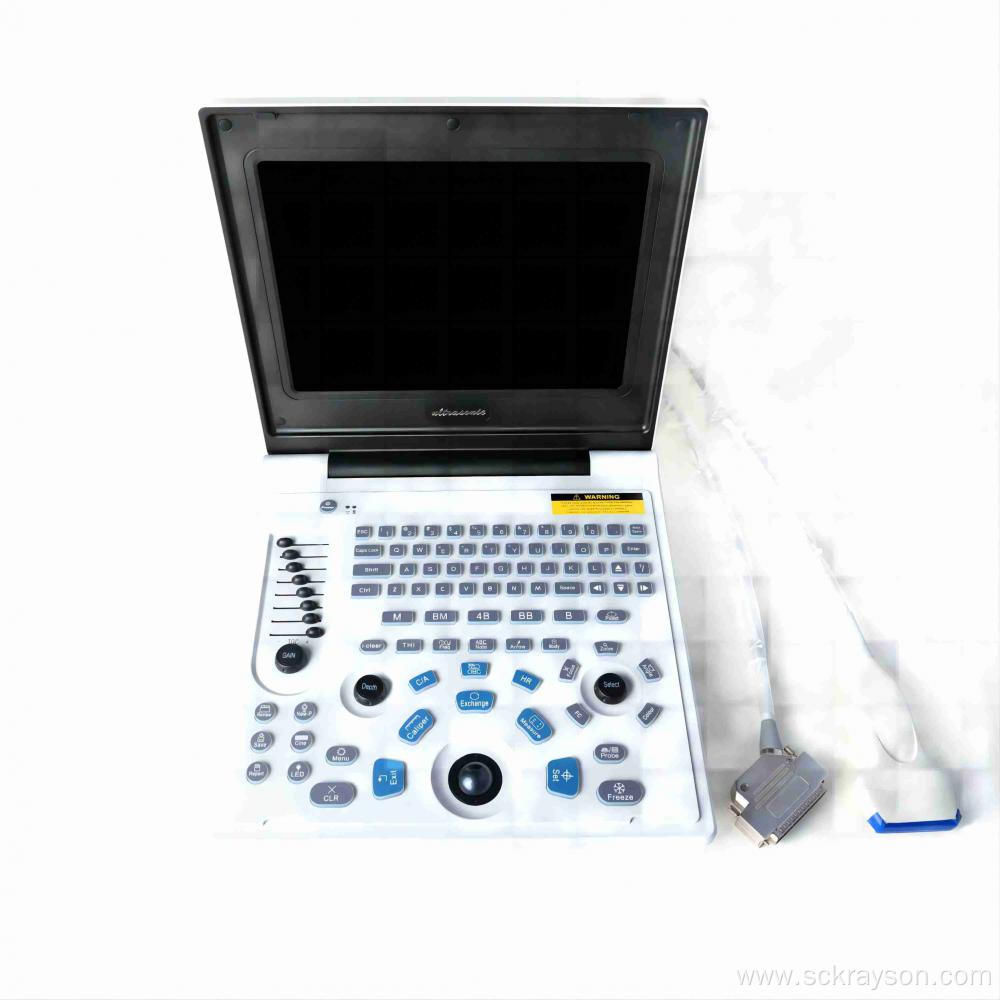 Female polycystic liver ultrasound diagnostic instrument