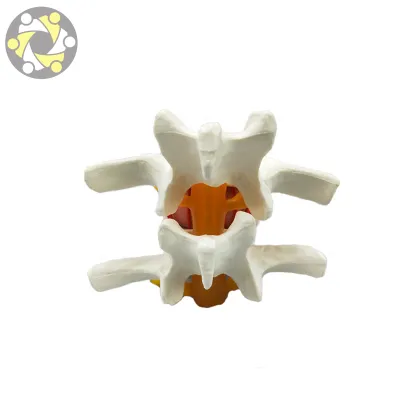 Vertebral Spine Simulator for Lumbar Disc Herniation Medical Science Model