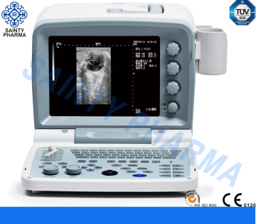 Full Digital Portable Ultrasound Scanner with CE ISO Ultrasound Sp200g