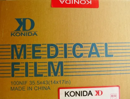 Knd-a 14in * 17in Medical Xray Dry Thermal Printer Film For Agfa 5300, 5302, 5500, 3000
