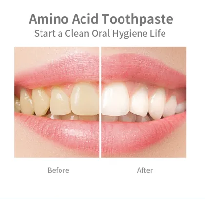 China Fresh White Tartar Control Toothpaste - Whitening & Sensitive Enzymatic Formula