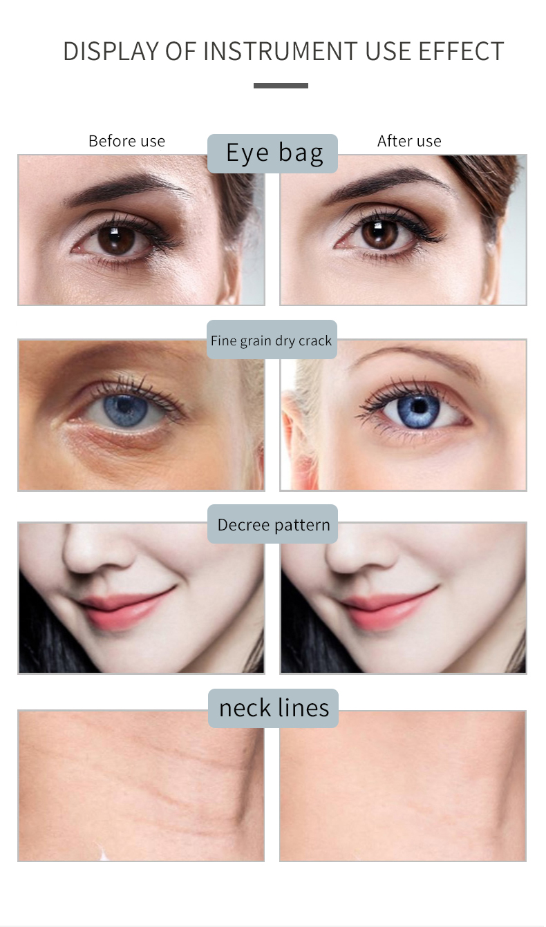 anti aging facial machine professional
