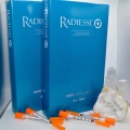 Radiesse Calcium Hydroxylapatite dermal filler with lido