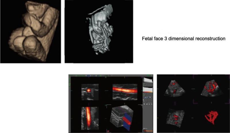 3D Fully-Digital Multi-Functional Color Doppler Ultrasound Systems with Touch-Screen