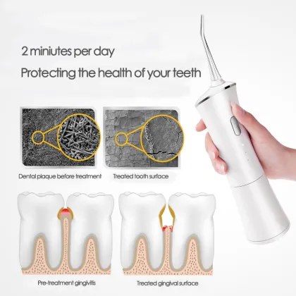 USB Rechargeable Water Jet Floss Toothpick - 5 Jet Tips, 150ml, Portable Dental Flosser