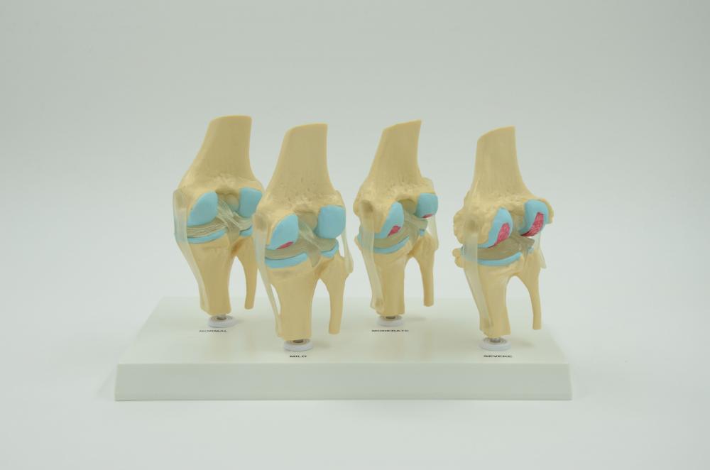 LESION KNEE JOINT MODEL