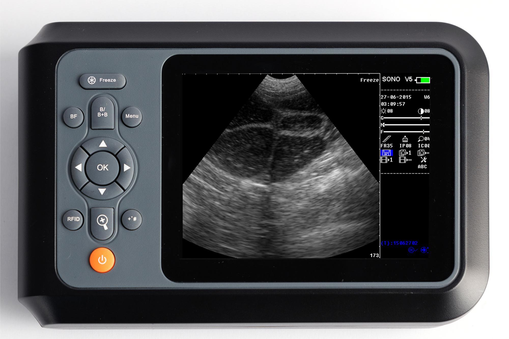 swine ultrasound pregnancy
