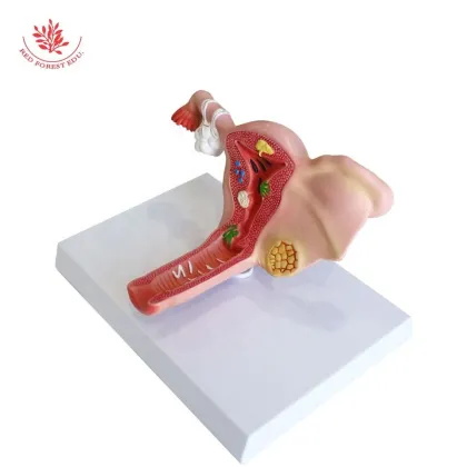 Life Size Female Uterus Anatomical Model for Teaching and Learning Resources