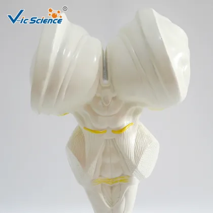 Brain stem amplification model