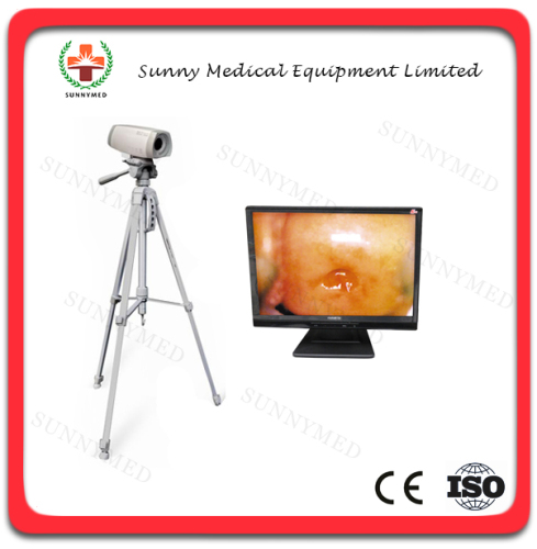 SY-F004 Hot Sale Medical Device Gynaecology Colposcope Price Electronic Colposcope