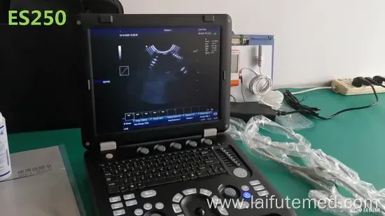 Veterinary Sonography System Es250V
