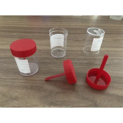 Automatic Plastic Urine Jar Assembly Machine Automation Machinery