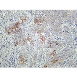 Anti-AMPKα1 Rabbit Monoclonal Antibody