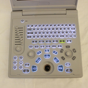 Sonostar SS-6B Ultrasound Machine