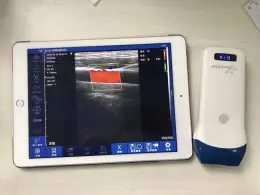 handheld wireless ultrasound for phone and pad