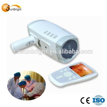 2015 handheld colposcope for sale